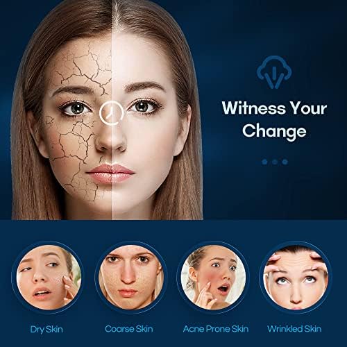 Facial Steam - Kingsteam nova generacija 5-u - 1 Nano facial parobrod za dubinsko čišćenje lica- proizvodite